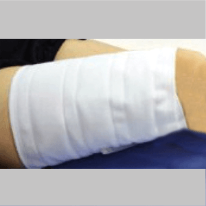 Compression Therapy System DVT Thigh Sleeve, Large (Unit Pair)