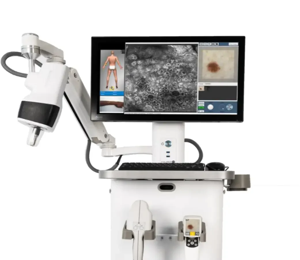 Vivascope combo in vivo confocoal microscope