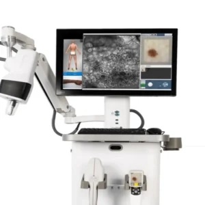 Vivascope combo in vivo confocoal microscope